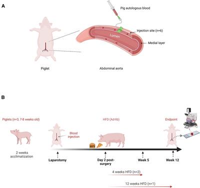 Injury to the tunica media initiates atherogenesis in the presence of hyperlipidemia
